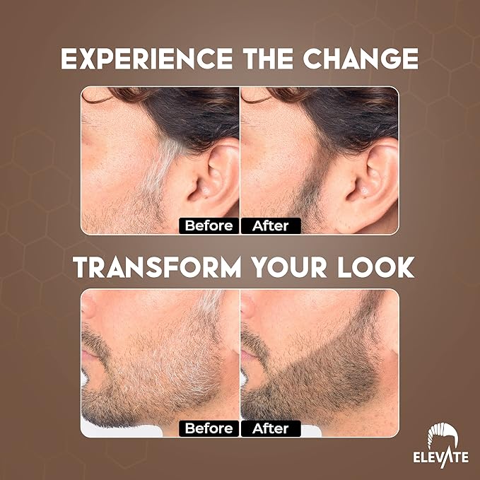 ELEVATE Hair Line Powder Instantly Conceal Hair Loss for Thinning Areas - Shadow Makeup - Root Cover Touch Up with Puff Touch - Instant Gray Coverage for Men and Women (Light Brown)