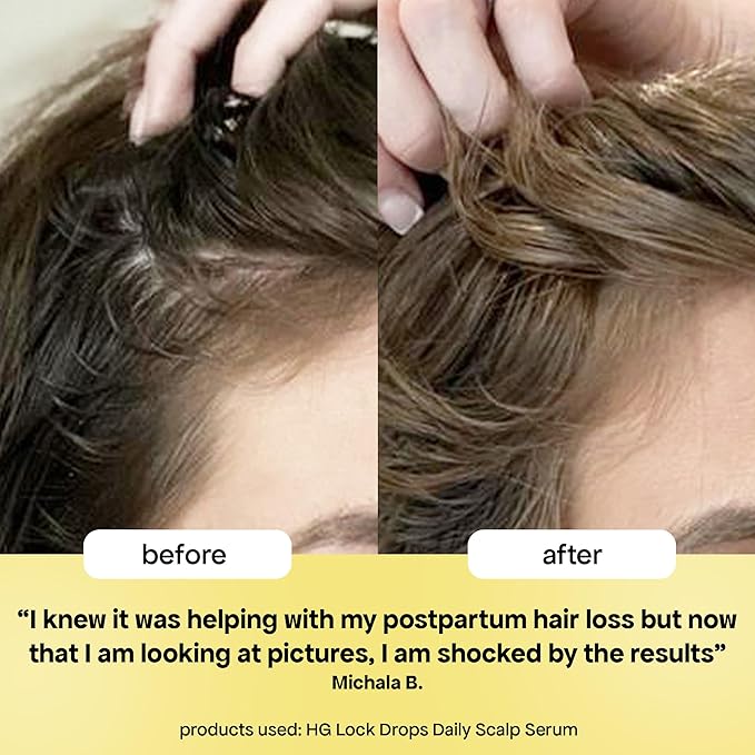BondiBoost HG Lock Drops Daily Hair Serum for Women – Non-Greasy, Reduces Hair Thinning, Stimulates Scalp, Supports Thicker Fuller Hair – Vegan, Color-Safe, Lightweight for All Hair Types & Textures