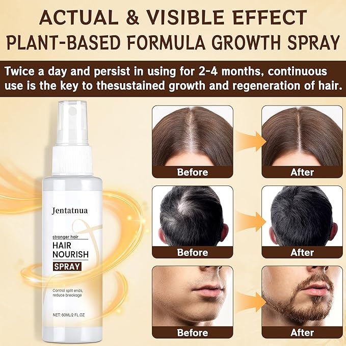 Hair Growth Spray, Natural Hair Growth Serum for Women With Rosemary Oil and Biotin Hair Oils, Prevent Hair Thinning & Anti-Hair Loss Treatment for Women & Men, Non-Greasy, 60ml Bottle