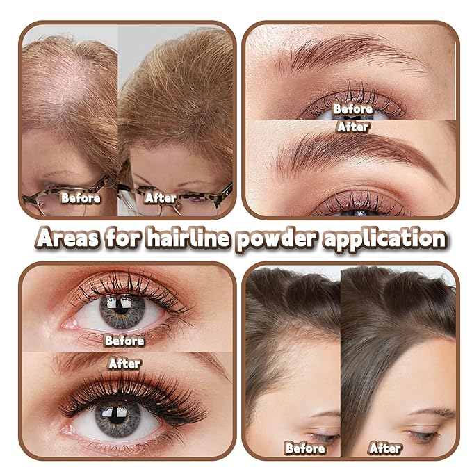 Root Touch Up Powder Hair Color Medium Brown, Root Cover Up Hair Powder for Women Scalp Concealer, HairlinePowder for Women GrayHair