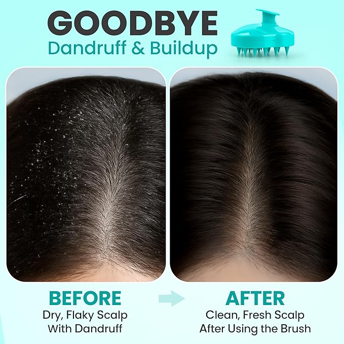 RELAXXO Scalp Massager Hair Growth – Exfoliator & Hair Scrubber for Scalp, Soft Bristles for Dandruff & Soothing Comfort, Shampoo Brush, Wet & Dry Use, Green