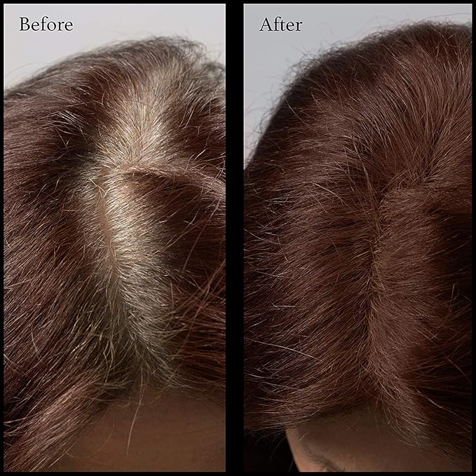 Hair Root Touch Up Powder - Dark Auburn - 11 True-to-Nature Root Concealer Shades - Long-Lasting, Clean, Fragrance Free, Talc & Paraben Free - For Women & Men