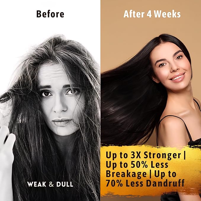 Hair Growth Serum Women & Men — USDA Organic, 10-in-1 Tricho10™ Scalp Serum for Thicker, Fuller Hair & a Healthier Scalp — Fast-Absorbing, 3X Strengthening Blend for Thin Hair & all Hair Types (30 ml)