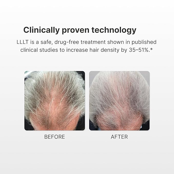 Hair Regrowth Cap | Laser Hair Growth Hat 136 Lasers, 6 Minute Treatment, FDA Cleared, Drug-Free, Flexible Fitting, Laser Hat For Hair Growth Red Light For Hair Loss Hair Regrowth Laser Cap