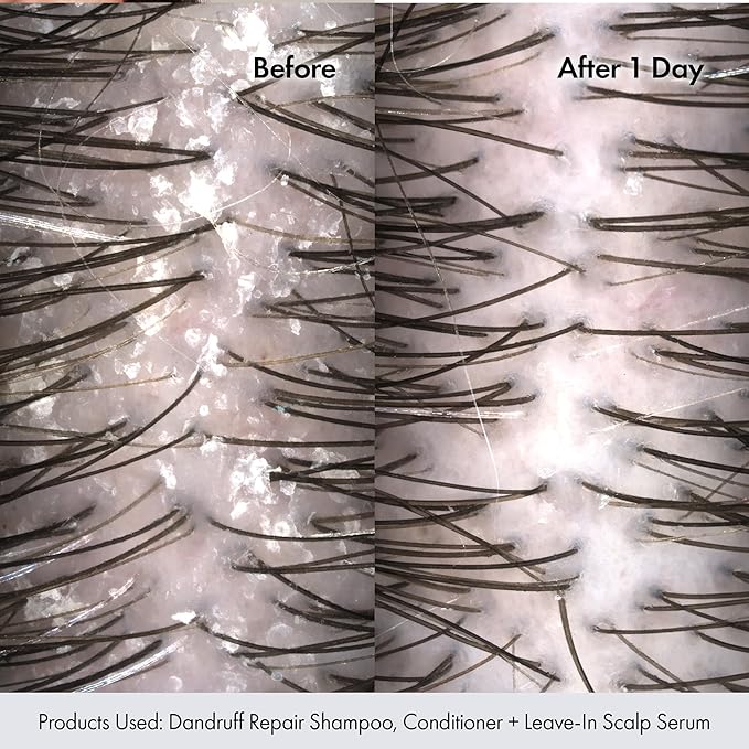BONDIBOOST Anti-Dandruff Repair Shampoo; Soothe and Revitalize Your Scalp - Relief for Itchy, Flaky, and Irritated Scalp, Promotes Healthy Hair and Long-Lasting Comfort