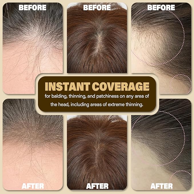 Root Touch Up Hair Color Powder For Concealing Hair Loss & Thinning, Gray Hair Shadow Powder Root Cover Up For Women & Men (Medium Blonde, 0.35 Ounce)