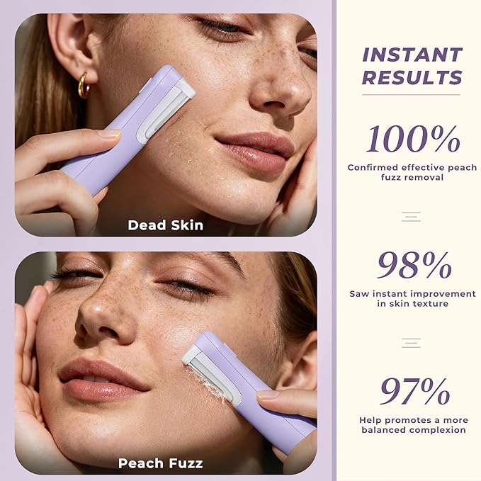 Dermaplane Razor for Women Face, WLU Rechargeable Face Dermaplaning Tool – Peach Fuzz, Facial Hair & Exfoliation Removal, Sonic Technology with LED Light, 3 Speeds & 10 Blades (Purple)