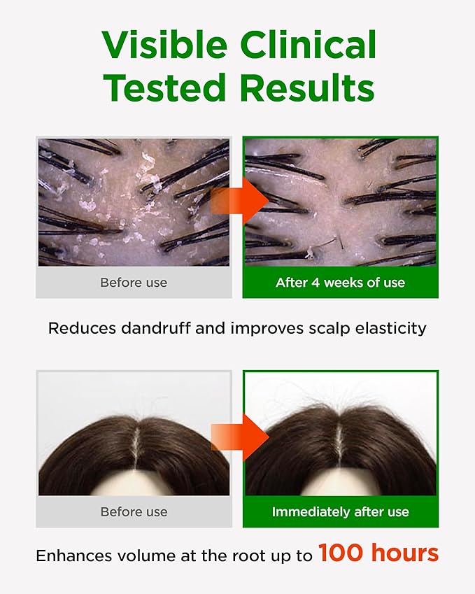 CKD Amino Biotin All-powerful Shampoo - Daily Shampoo for Hair and Scalp, Promotes Hair Growth, Repairs Damaged Hair, Enhances Healthy Hair, and Thickens Hair. Korean Hair Care. 16.9 fl oz