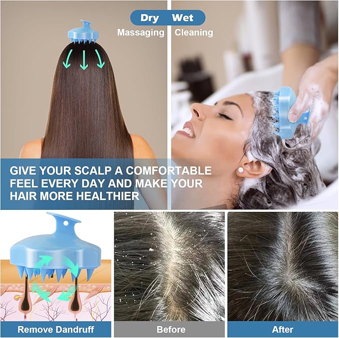 URTHEONE Hair Scalp Massager Shampoo Brush,Soft Silicone Hair Brush for Wet Dry Oily Curly Straight Thick Thin Rough Long Short Natural Men Women Kids Pets Hair Care Tools(Sky Blue)