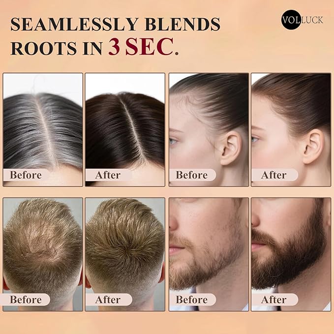 VOLLUCK Hairline Powder Instantly, Root Touch up Powder Hair Color Upgraded, Grey Root Cover up Conceals Hair Loss, Hairline Shadow for Women & Men for Thinning Hair Natural, Sweatproof (Brown)