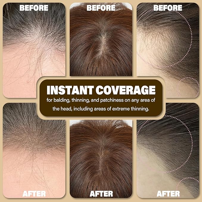 Root Touch Up Hair Color Powder For Concealing Hair Loss and Thinning, Gray Hair Shadow Powder Root Cover Up Hairline Powder For Women Men Eyebrows, Beard Line (Light Blonde, 0.35Ounce)