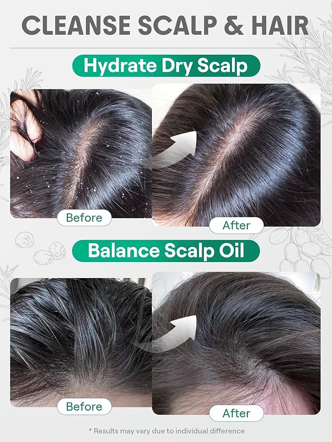 SHEGLAM Hair & Scalp Oil - 0.5 fl oz, Hydrating Serum, Macadamia & Grapeseed Oils, Soothes Dry Scalp, Balances Sebum, Adds Shine, For Sensitive Scalp & Dandruff (Rosemary)