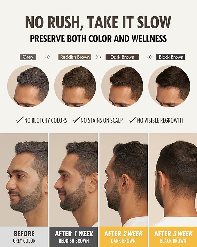 MODA MODA Zero Gray Black Hair Shampoo 3.52 oz - Natural Darkening Color Shampoo Dye for Hair & Scalp | Age-Defying & Volumizing Grey Shampoo that Reduces Hair Breakage - No Animal Trials
