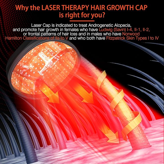 Laser Cap (FDA Cleared), Professional Medical Grade Laser Hair Growth Treatment Product for Men & Women, Red Light Therapy for Hair Growth, Treat Alopecia