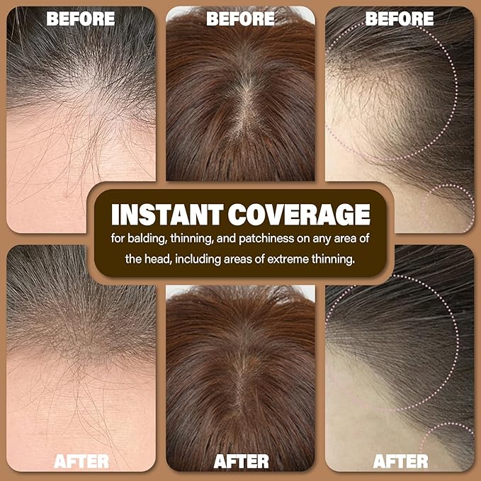 Root Touch Up Hair Color Powder For Concealing Hair Loss and Thinning, Gray Hair Shadow Root Cover Up Hairline Powder For Women Men Eyebrows, Beard Line (Dark Blonde, 0.35 Ounce)