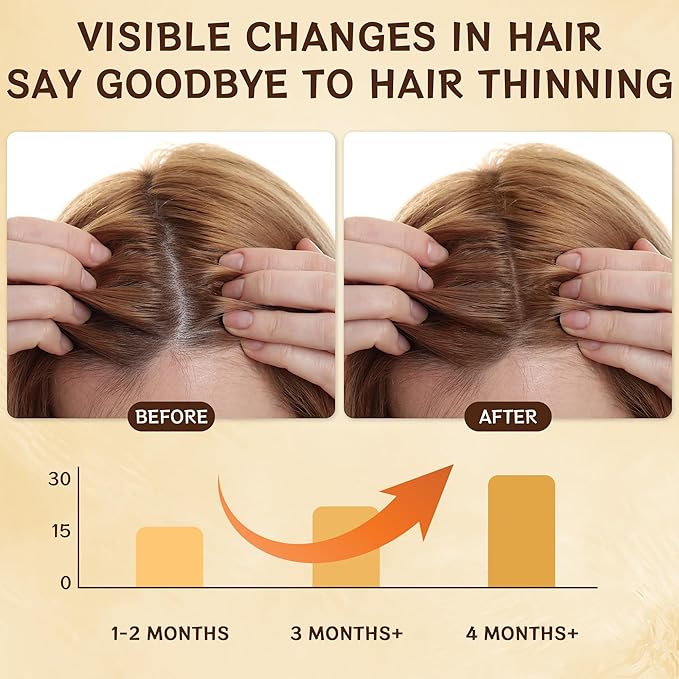 Hair Growth Spray, Natural Hair Growth Serum for Women With Rosemary Oil and Biotin Hair Oils, Prevent Hair Thinning & Anti-Hair Loss Treatment for Women & Men, Non-Greasy, 60ml Bottle