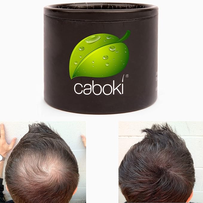 Hair Loss Concealer. Cover Bald Spot and Thinning Hair Instantly. Make Thin Hair Look 10X Fuller. All-Natural Hair Building Fiber. Trial Size (10-Day Supply). Dark Brown