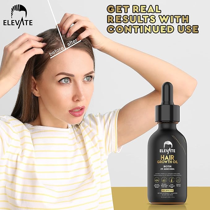 Elevate Hair Regrowth Treatment 5% Minoxidil Solution – Biotin Serum Hair Growth Oil for Men & Women - Thicker Fuller Stronger Hair - Stops Hair Loss & Thinning - Natural Hair Thickening Treatment 2oz