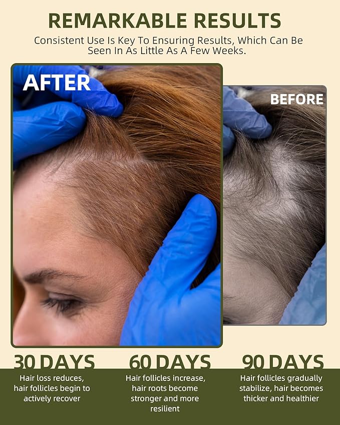 100% Natural Raw Batana Oil for Hair Growth, Dr Sebi Hair Growth Oil From Honduras, Thicker & Stronger Hair, Prevents Hair Loss, Eliminates Split Ends 4.23 Fl Oz (Pack of 2)