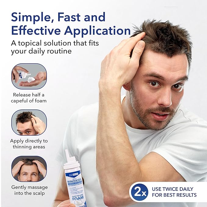Minoxidil Foam for Men 5% Percent - Men's Hair Growth Treatment for Him- Topical Foaming Minoxidil for Men- Great for Hair Regrowth and Reduce Hair Loss - 1 Pack as 1 Month Supply