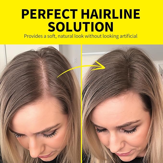Sevich Hairline Powder - Root Touch Up Instantly Hair Color for Thinning Gray Coverage - Bald Spot Concealing Hair Powder for Women & Men - 48Hour Waterproof & Sweatproof - Dark Brown