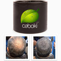 Hair Fibers For Hair Loss. Cover Bald Spot and Thinning Hair Instantly. Make Thin Hair Look 10X Fuller. All-Natural Hair Building Fiber. Trial Size (10-Day Supply). Dark Gray