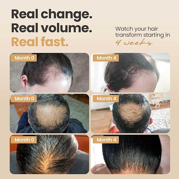 Vitasei Hair Booster 2 Fl Oz (2 Pack) – Hair Revitalizing Serum with Capilia Longa, Wild Olive Stem Cells & Arginine – Peptide-Enriched Hair Tonic Supports Thicker, Stronger Hair – For Women & Men