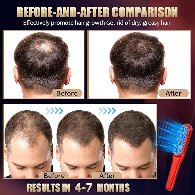 Laser Hair Growth Comb，Red Light Hair Growth Treatment for Men & Women（Red 1pcs ）