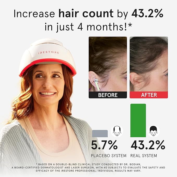 iRestore Professional + Rechargeable Battery Pack - Laser Red Light Therapy for Hair Growth - FDA Cleared Hair Loss, Thinning Treatment for Men & Women - Hair Regrowth Cap - 282 Lasers & LEDs