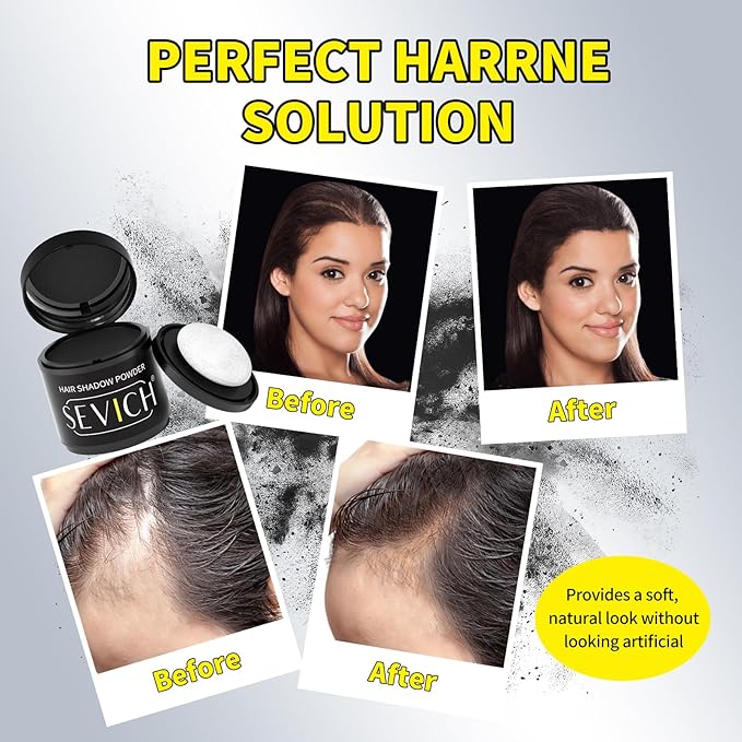 Sevich Hairline Powder 10g with Brush, Instantly Conceals Hair Loss & Thinning & Gray, 48H Waterproof Root Touch Up Powder, Natural Hair Shadow Toppers for Women & Men, 1 Box = 2.5 Boxes,Dark Brown