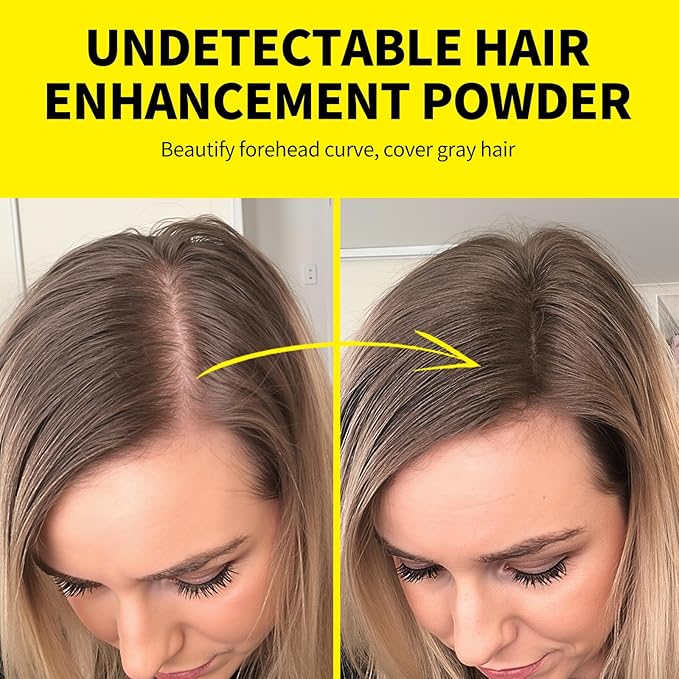SEVICH Root Touch Up Hair Color Powder with Mirror & Brush – Instant Gray Hair Cover Up, Waterproof Sweatproof Formula, Natural Finish for Hairline & Bald Spot, 48H Long Lasting, Dark Brown