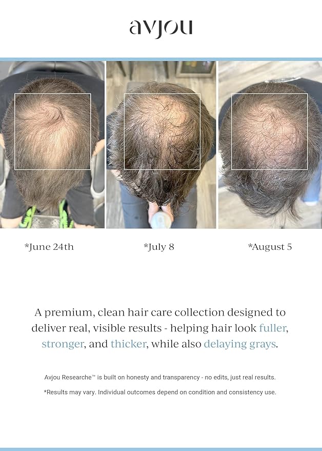 Avjou Researche™ Scalp Serum – Thicker, Fuller-Looking Hair + Targets Visible Signs of Premature Greying – 3 Patented Ingredients – Backed by Cosmetic Science – Oil-Free, All Hair Types, 1.7 oz