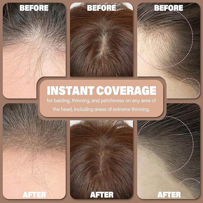 Root Touch Up Hair Color Powder for Concealing Hair Loss & Thinning, Gray Hair Shadow Root Cover Up for Women & Men (Light Brown, 0.35Ounce)