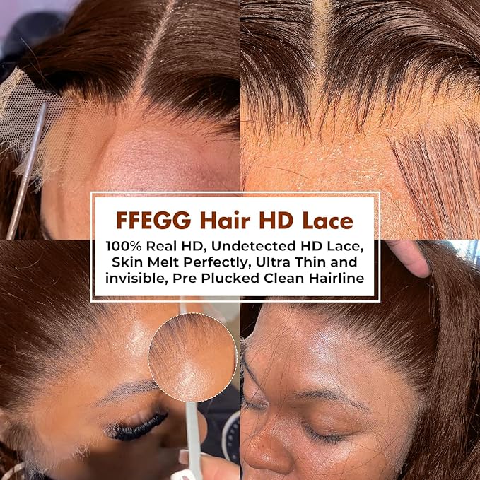 5x5 SKINLIKE Real HD Lace Closure Wig, Chocolate Brown Loose Body Wave 250% Density 0.10mm Ultra-thin Swiss Lace Pre-plucked Bleached Small Knots With Baby Hair Brown Wig Human Hair Wigs 18 Inch