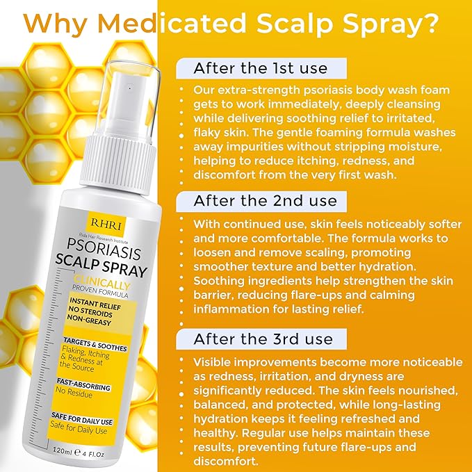 Psoriasis Scalp Spray | Psoriasis and Dandruff Treatment for Scalp Yeast Infections, Psoriasis Flare-Ups & Folliculitis | Antifungal Ringworm Itchy Scalp Spray for Psoriasis, Dryness