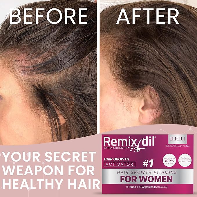 Hair Growth Vitamins Hair Growth Supplements For Women | Supports Thickness And Strength | Helps Reduce Breakage And Thinning | Promotes Healthy Scalp Function | 60 Capsules