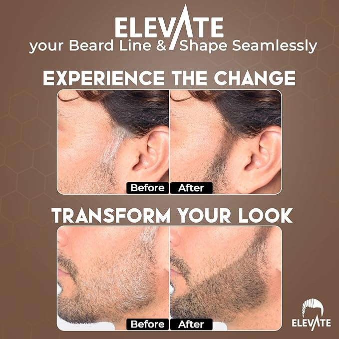 ELEVATE Hair Line Powder Instantly Conceal Hair Loss for Thinning Areas - Shadow Makeup - Root Cover Touch Up with Puff Touch - Instant Gray Coverage for Men and Women (Black)