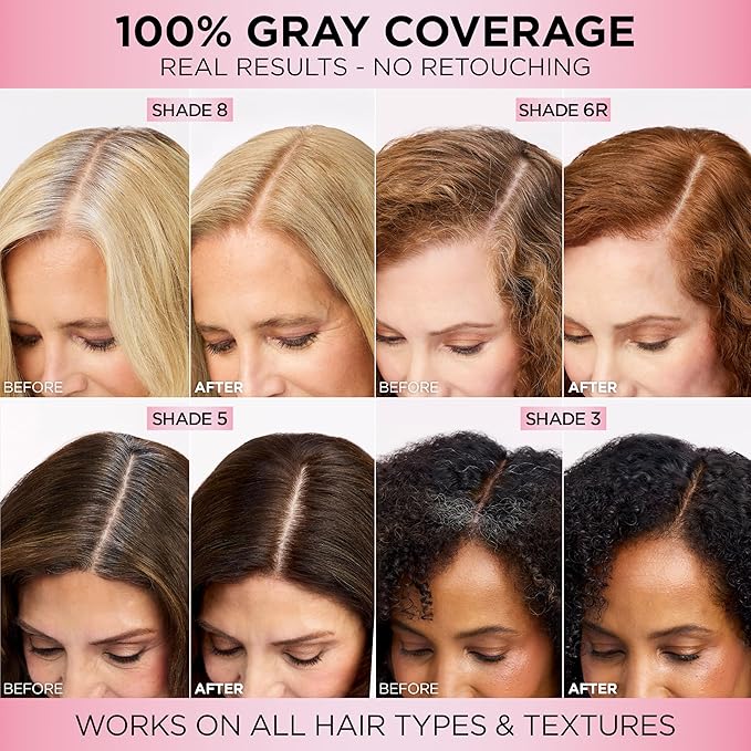 L'Oreal Paris Excellence Crème Permanent Hair Dye, Triple Care Hair Color with Pro-Keratine Complex for 100% Gray Hair Coverage, 10 Lightest Ultimate Blonde, 1 Kit
