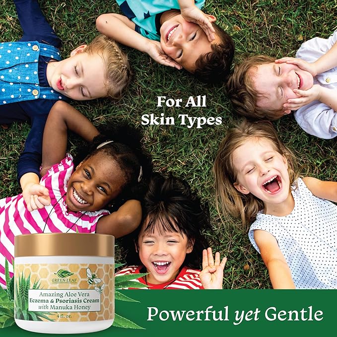 Manuka Honey Eczema Cream Moisturizing Lotion Fragrance Free For Psoriasis Relief - Itchy, Dry Skin Rash Ointment - Skin Soothing Moisturizer - Body & Face Cream - Kids & Adults 16oz
