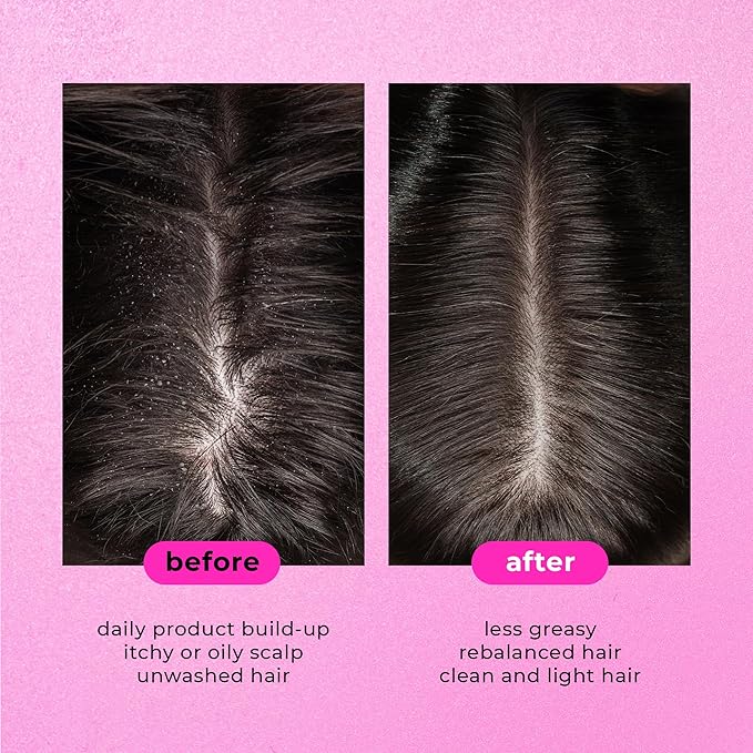 Sea Salt Scrub Shampoo scalp detox treatment