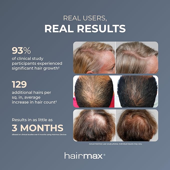 Hairmax PowerFlex 272 Laser Cap - (FDA Cleared) Thinning Hair Loss Solution for Men & Women - Flexible Cordless Design With 7 Minute Treatment Time - Red Light Therapy to Stimulate Hair Growth
